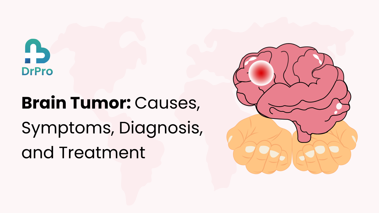 Brain Tumor: Causes, Symptoms, Diagnosis and Treatment